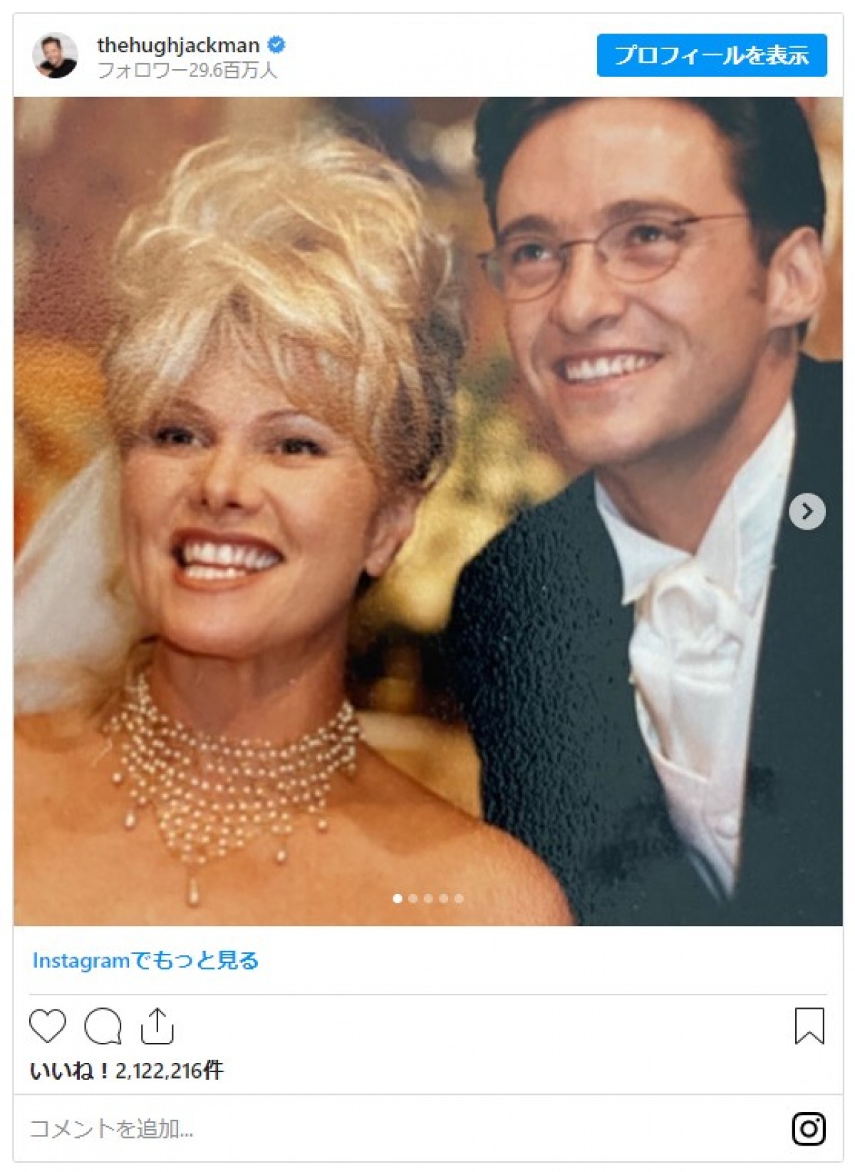 愛妻家ヒュー・ジャックマン、結婚25周年を記念しウェディング写真公開