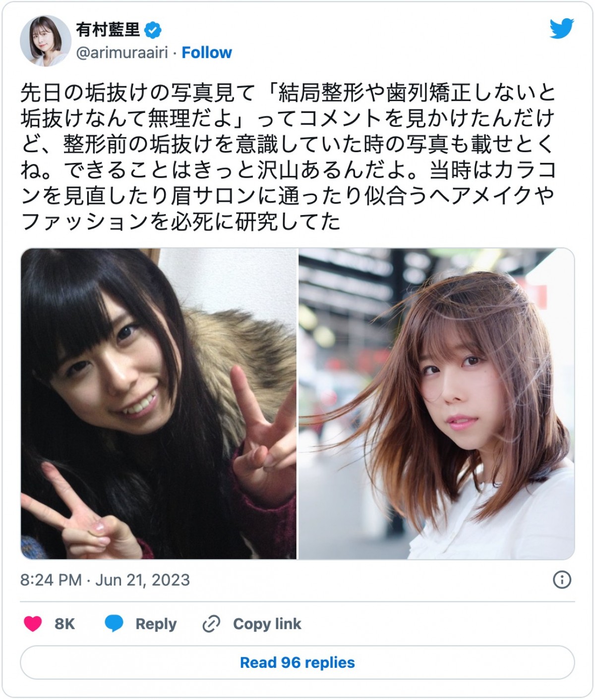 有村藍里、整形の理由　妹・有村架純へのコンプレックスではない「劣等感は一切ない」