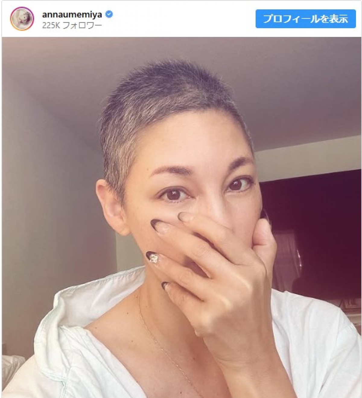 闘病中の梅宮アンナ、短髪ヘアでインスタ更新　※「梅宮アンナ」インスタグラム