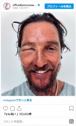 マシュー・マコノヒーがハチに刺されまるでお岩さん！　片目が腫れた写真公開するも「それでもまだ俺よりカッコいい」と評判※「Matthew McConaughey」インスタグラム