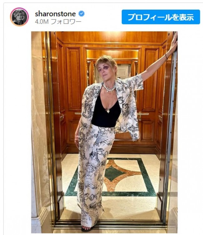 シャロン・ストーン、目の周りに黒いあざの写真公開※「Sharon Stone」インスタグラム