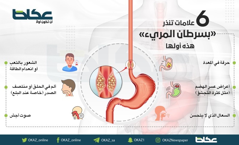 6 علامات تنذر بسرطان المريء